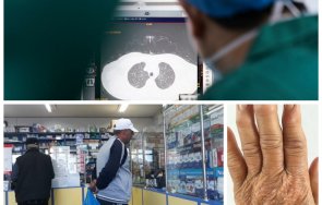 нов подход медикаменти артрит спасяват covid