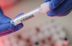 словаците изтрещяха искат отрицателен тест covid излизане вкъщи