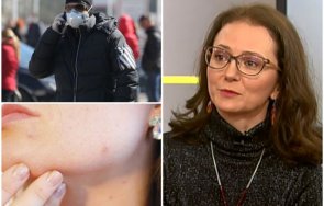 топ дерматологът доц весела райкова важни новини какви поражения причинява covid кожата справим обривите маските дезинфектантите