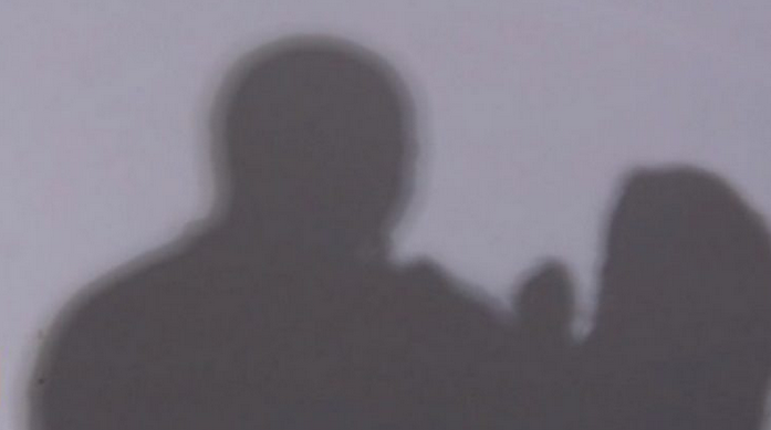 Мъж обезобрази приятелката си с макетно ножче, направени са ѝ 400 шева ...