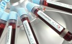 Рекордните 115 000 новозаразени с коронавируса за денонощие регистрираха в Бразилия