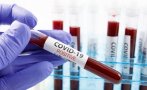 Преболедувалите леко COVID-19 имат антитела до една година