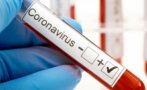 ПОСЛЕДНИ ДАННИ: 1350 са новите случаи на COVID-19, още 13 българи загубиха битката с вируса