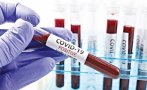 НОВ РЕКОРД: 5863 са новозаразените с коронавирус, 243 са починалите за денонощието
