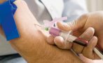 всеки случай годишен дядо изследва хив