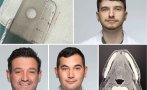 лекари спасиха мъж рядко опасно усложнение рибена кост в пловдив