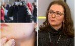 Топ дерматологът доц. Весела Райкова с важни новини - какви поражения причинява COVID върху кожата, как да се справим с обривите от маските и дезинфектантите