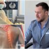 вторник 0900 часа пик топ неврохирургът едвин васви ранната диагностика огромно значение заболявания гръбначния стълб харчете парите хранителни добавк